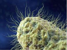 Decomposition Odor After a Death: Why It Lingers
